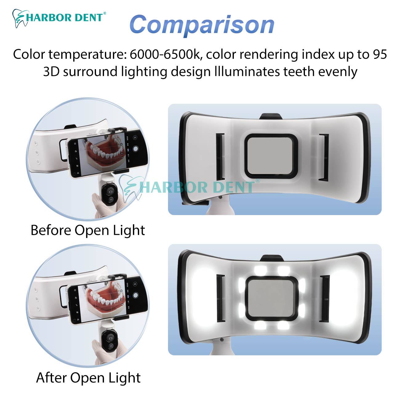 お手頃価格 歯科撮影用モバイルライト 明るさ調整可能 口腔内 - Good Lighting In Photography のレビューと価格
