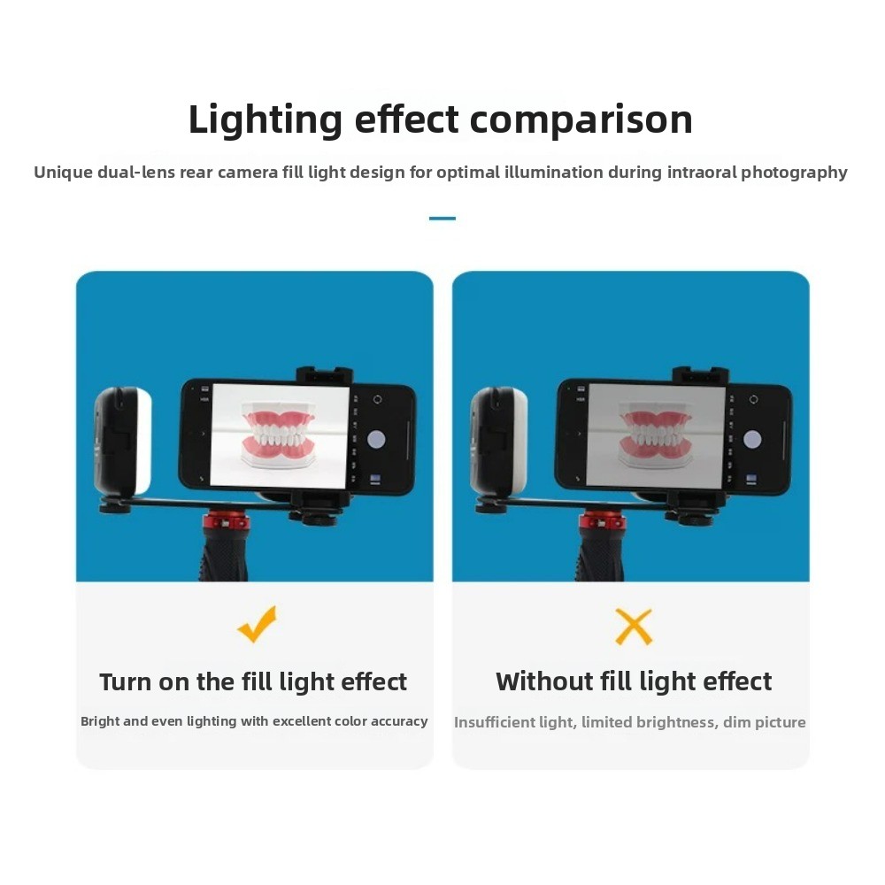 歯科用撮影ライト、スマートフォン用Bluetooth LED - Photography Lighting Basics のレビューと価格